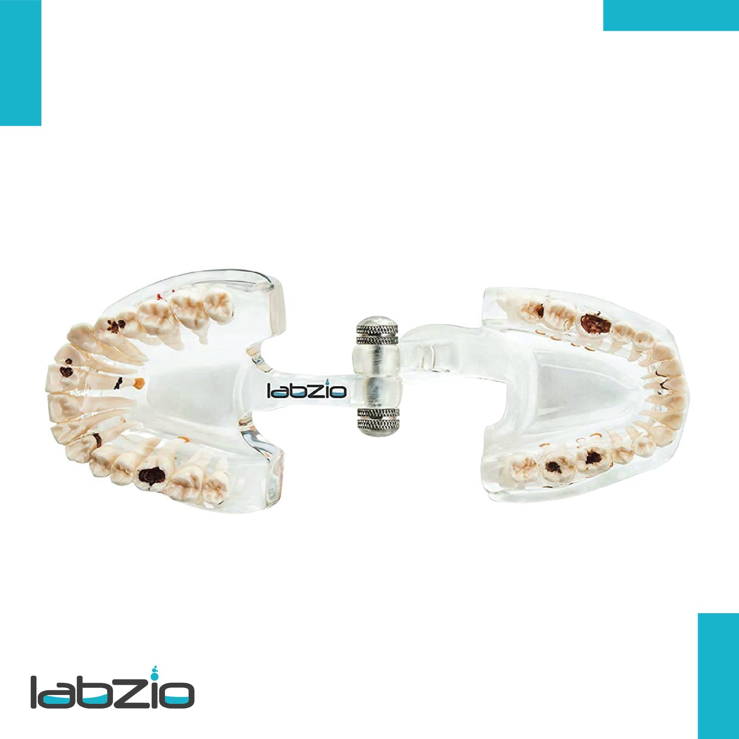 LABZIO Premium Dental Model, Normal Dentition and Occlusion, Affected Side Shows Multiple Pathologies, Made of Yellowish Transparent High Quality Unbreakable Acrylic