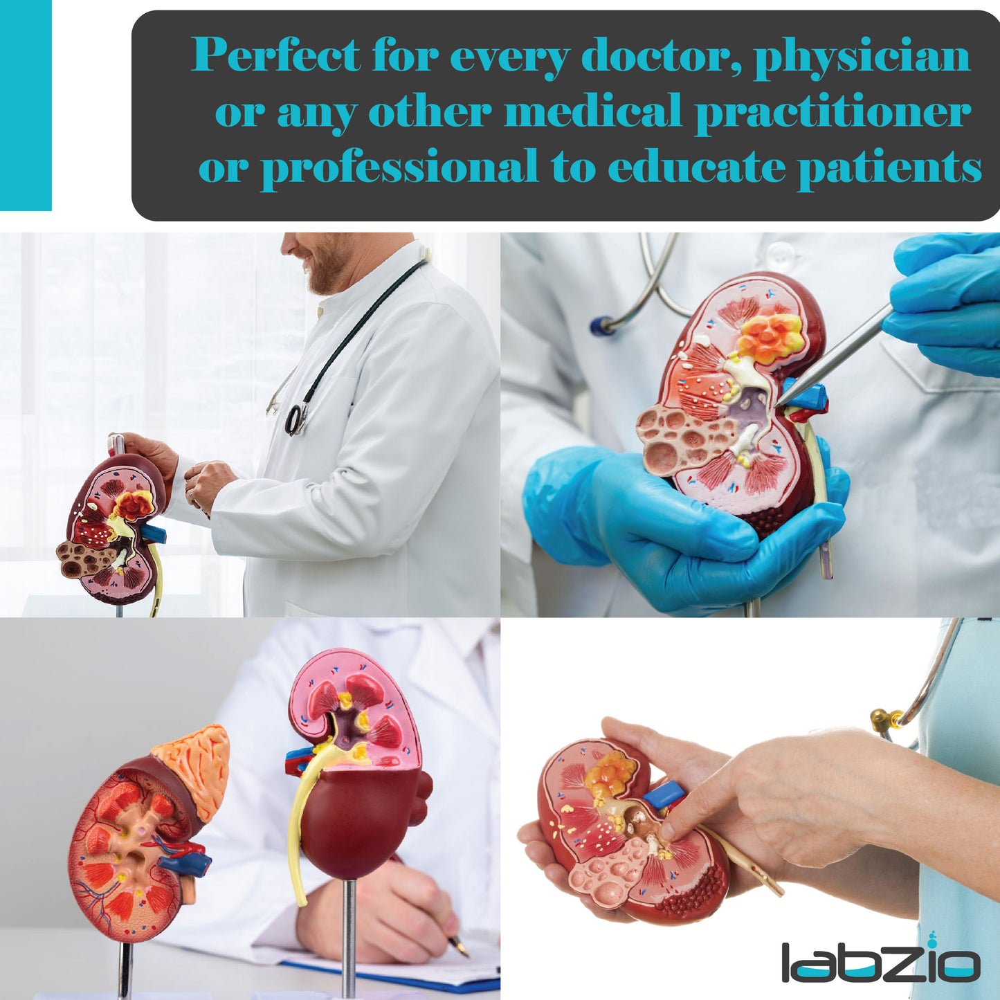 Labzio - Deluxe Human Kidney Anatomical Model, Demonstrating Normal and Diseased Kidney with Pathologies, Medical Grade Anatomical Model