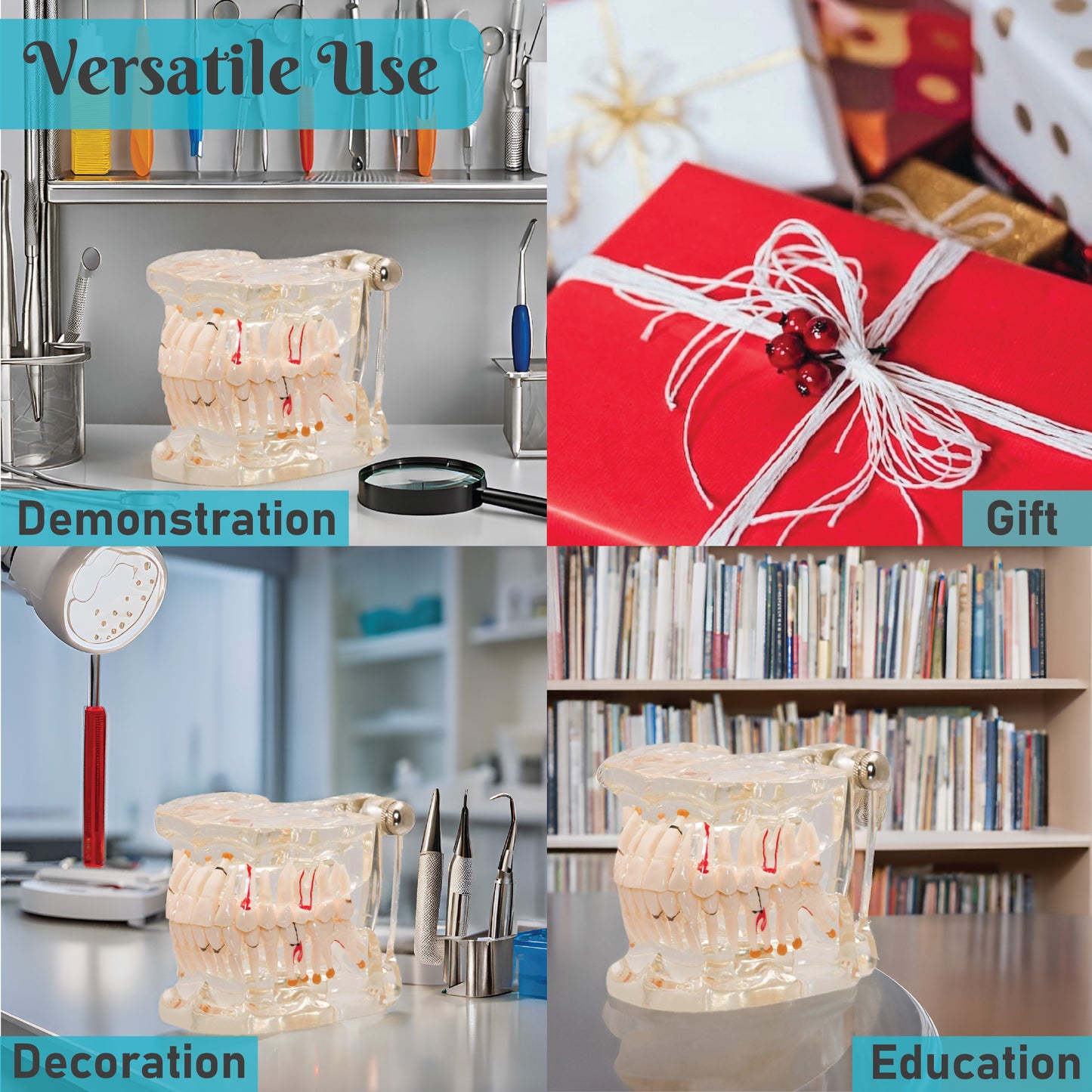 LABZIO Premium Dental Model, Normal Dentition and Occlusion, Affected Side Shows Multiple Pathologies, Made of Yellowish Transparent High Quality Unbreakable Acrylic