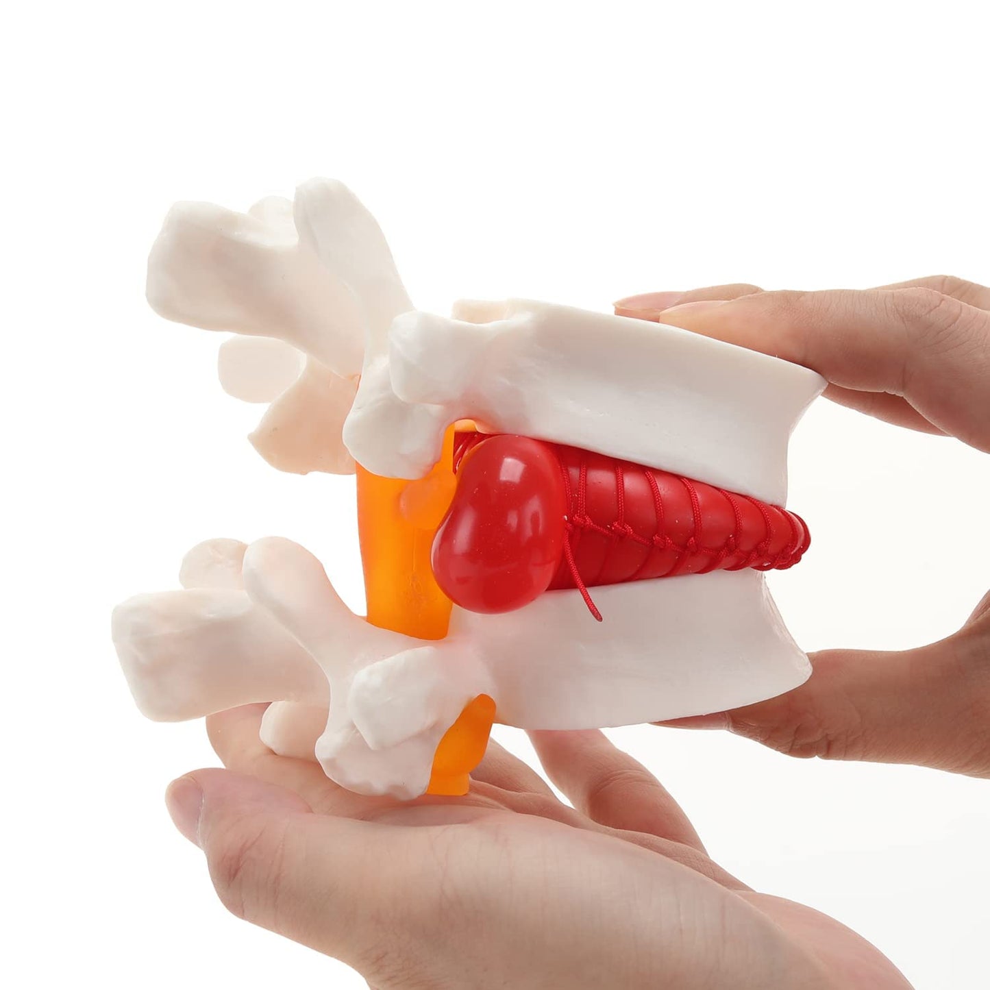 LABZIO Prime Model Of Demonstrational Lumbar Vertebrae With Prolapse, 2 Times Enlarged