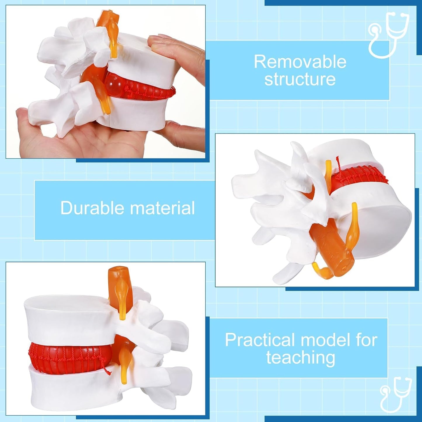 LABZIO Prime Model Of Demonstrational Lumbar Vertebrae With Prolapse, 2 Times Enlarged
