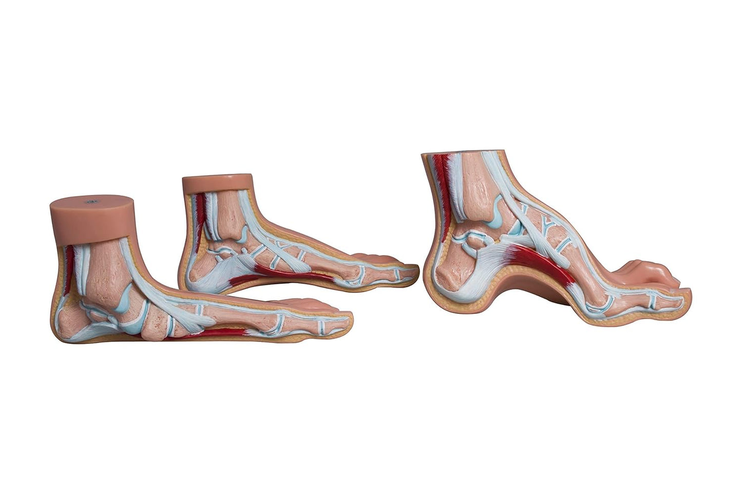 Labzio- Normal foot, Arched Foot, Flat Foot coloured models, Natural size, Set of 3,with detailed coloured key cards-3
