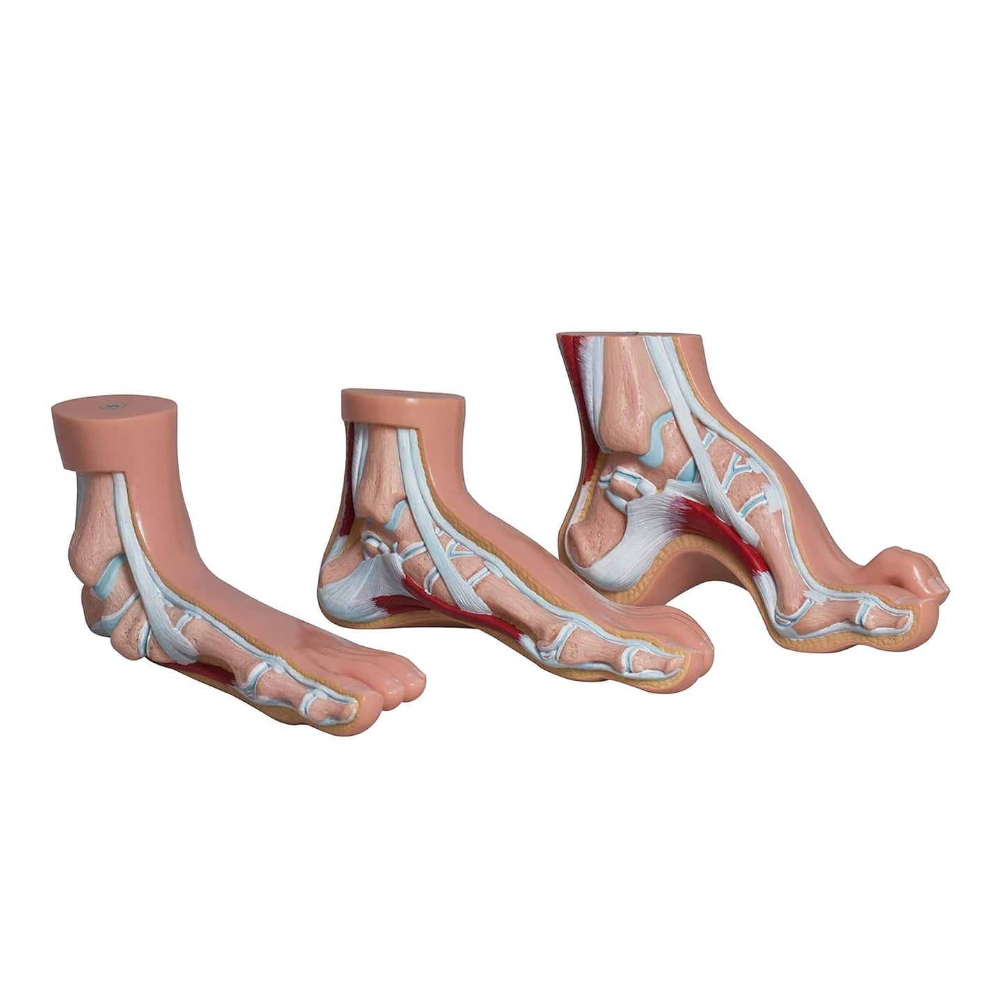 Labzio- Normal foot, Arched Foot, Flat Foot coloured models, Natural size, Set of 3,with detailed coloured key cards-3