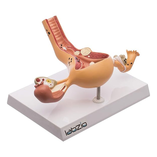 Labzio - Uterus and Ovary Anatomical Model with Pathologies | Female Reproductive Organ Replica with Base and Detailed Key Card | Medical Education Tool