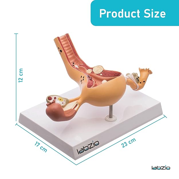Labzio - Uterus and Ovary Anatomical Model with Pathologies | Female Reproductive Organ Replica with Base and Detailed Key Card | Medical Education Tool