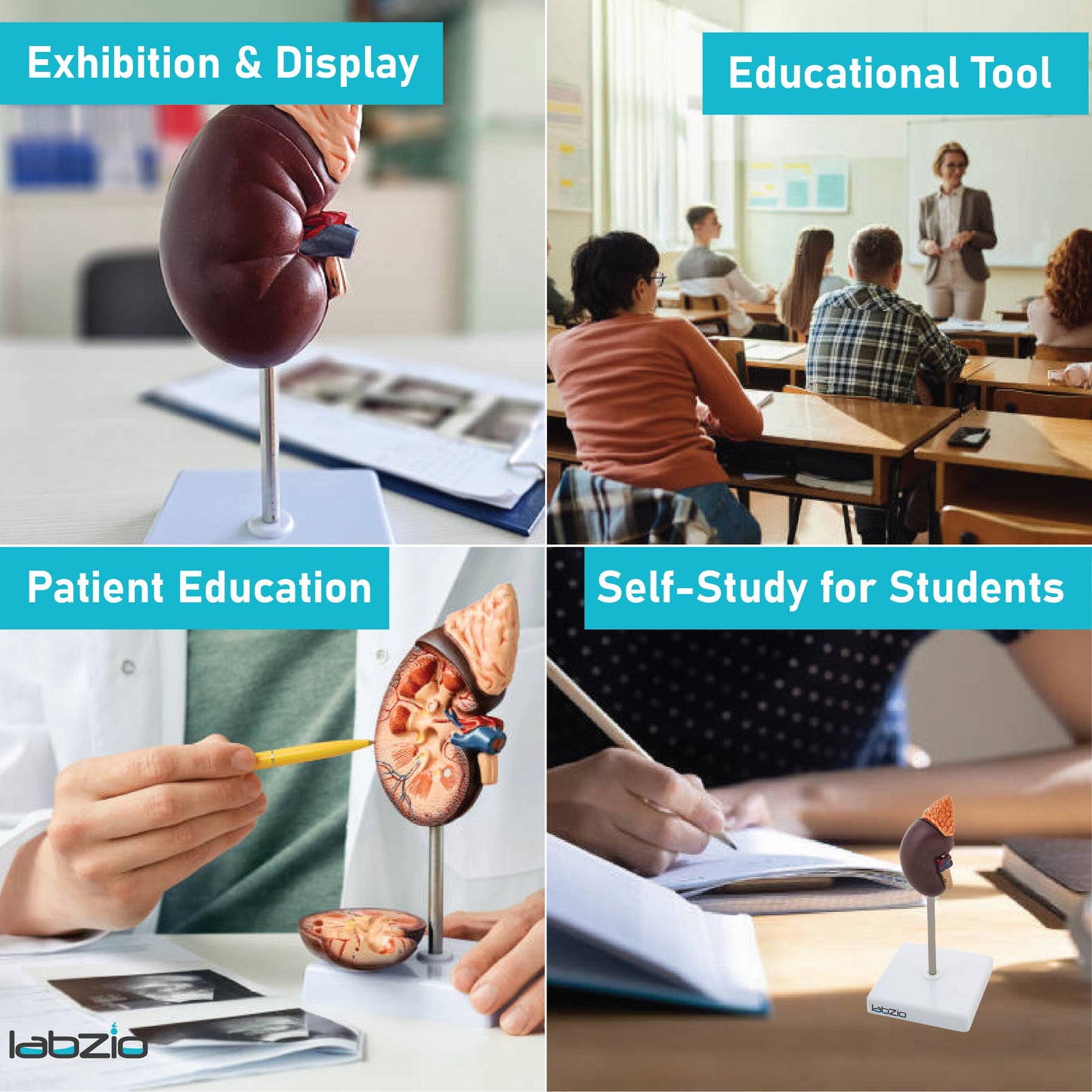 Labzio - Premium Human Kidney Model with Adrenal Gland – Dissectible Anatomical Model with Detailed Key Card for Education and Study