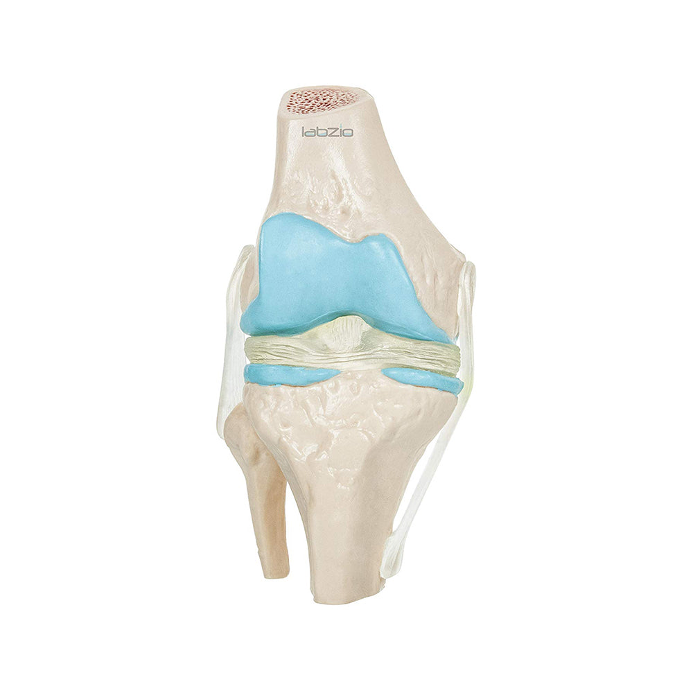Labzio - 4 Stage Osteoarthritis Anatomical Knee Model, Model On Base, With Detailed Study Guide