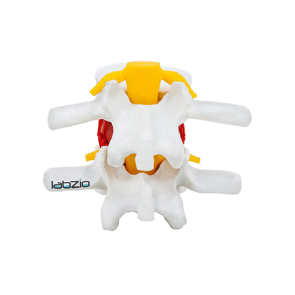 LABZIO Prime Model Of Demonstrational Lumbar Vertebrae With Prolapse, 2 Times Enlarged