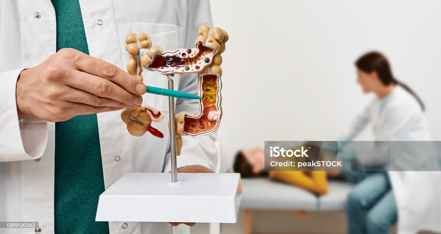 Labzio - Medical Anatomical Human Colon Diseased (Large Intestine) Model with Pathologies, Gastro Model, Perfect For Study and Patient Education