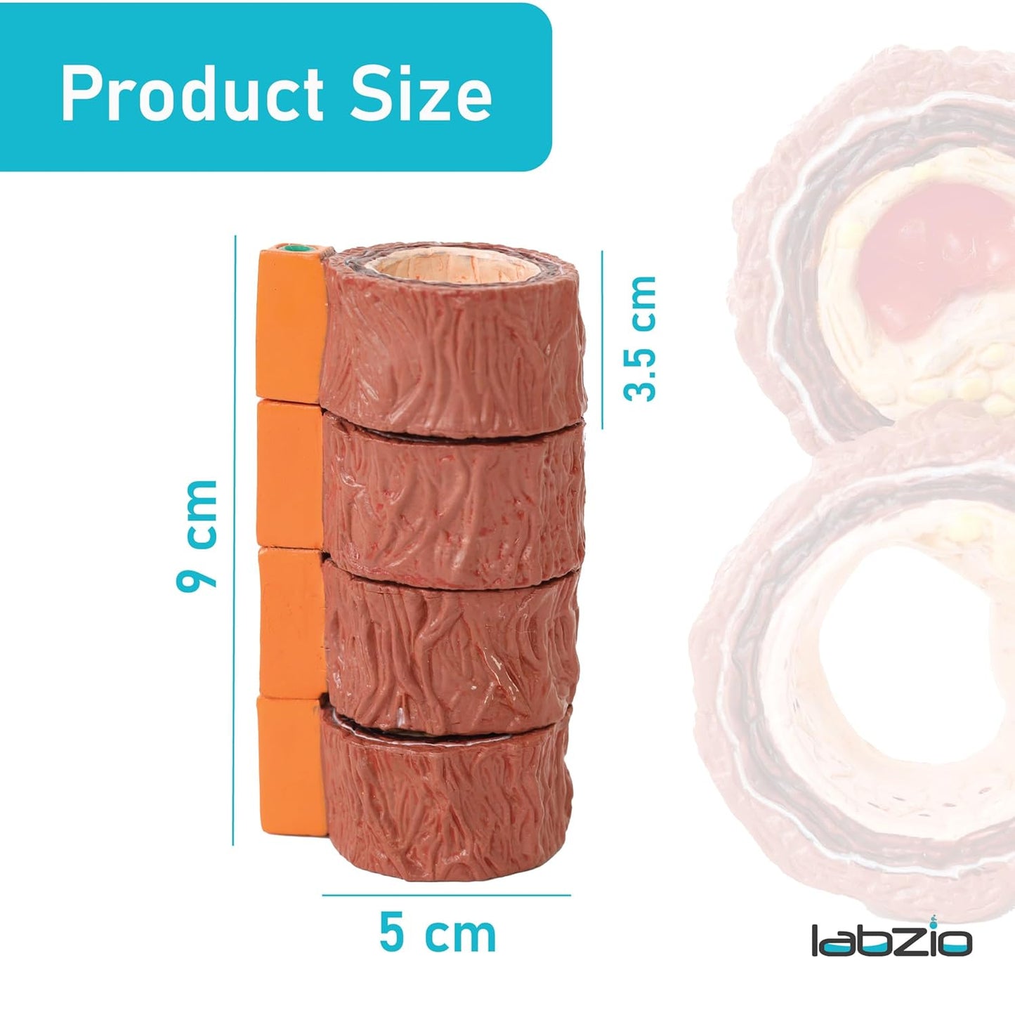 Human Artery Model (Mini) Portraying 4 Stages of Cholesterol Atherosclerosis (Normal, Fatty Streak, Atheroma and Fibrous Plaque and Blockage)