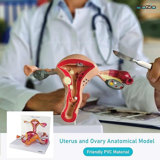 Labzio - Uterus and Ovary Anatomical Model with Pathologies | Female Reproductive Organ Replica with Base and Detailed Key Card | Medical Education Tool