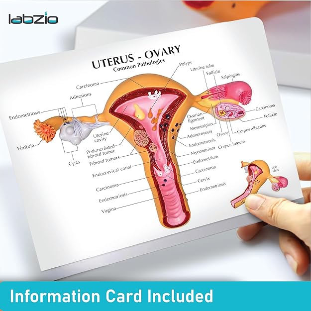 Labzio - Uterus and Ovary Anatomical Model with Pathologies | Female Reproductive Organ Replica with Base and Detailed Key Card | Medical Education Tool