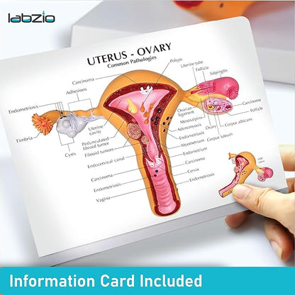 Labzio - Uterus and Ovary Anatomical Model with Pathologies | Female Reproductive Organ Replica with Base and Detailed Key Card | Medical Education Tool
