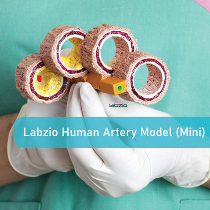 Human Artery Model (Mini) Portraying 4 Stages of Cholesterol Atherosclerosis (Normal, Fatty Streak, Atheroma and Fibrous Plaque and Blockage)