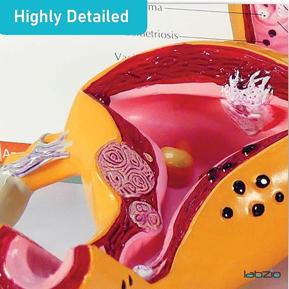Labzio - Uterus and Ovary Anatomical Model with Pathologies | Female Reproductive Organ Replica with Base and Detailed Key Card | Medical Education Tool