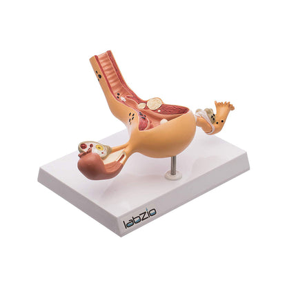 Uterus and Ovary ,Female Reproductive Organ Anatomical Model with base showing the common Pathologies , coloured detailed key card included (1)