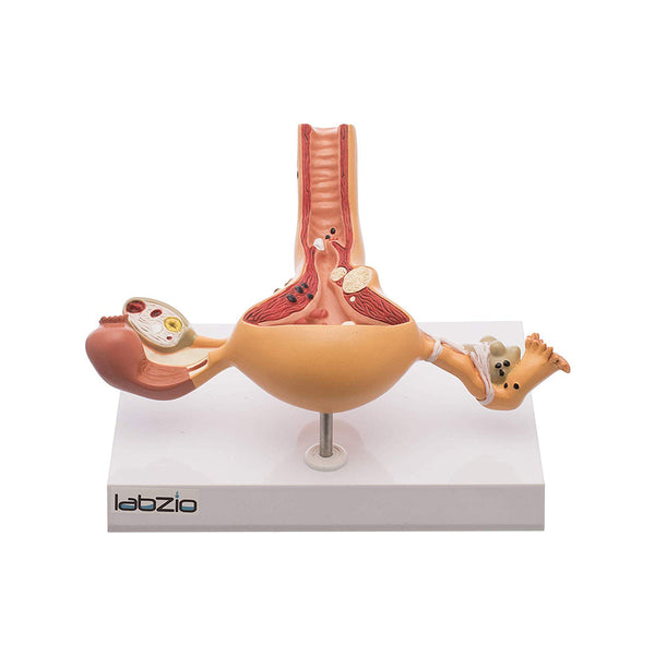 Uterus and Ovary ,Female Reproductive Organ Anatomical Model with base showing the common Pathologies , coloured detailed key card included (1)