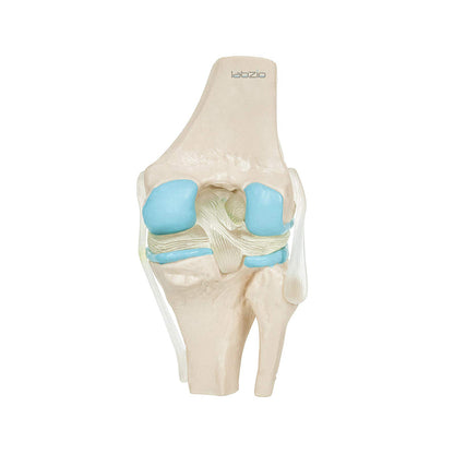 4 Stage Osteoarthritis Anatomical Knee Model, Model On Base, with Detailed Study Guide