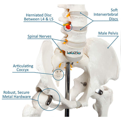 Human Skeleton Model Showing Spinal Nerves - 170 cm, Anatomically Correct
