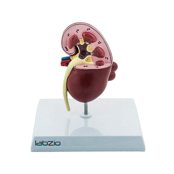 Deluxe Human Kidney Anatomical Model, Demonstrating Normal and Diseased Kidney with Pathologies, Medical Grade Anatomical Model