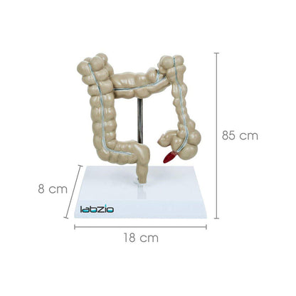 Medical Anatomical Human Colon Diseased (Large Intestine) Model with Pathologies, Gastro Model, Perfect For Study and Patient Education