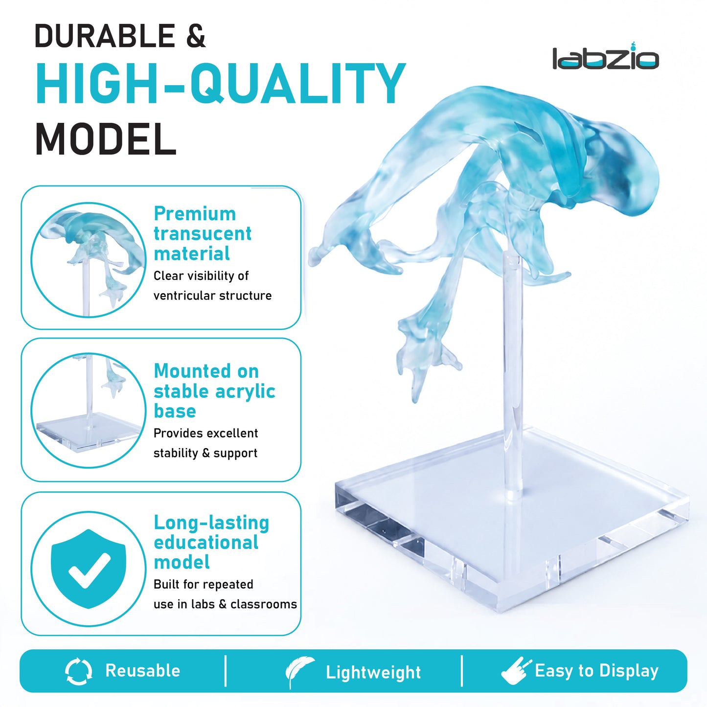 Labzio- Brain Ventricle Model